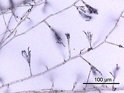 菌糸の構造と生態に関する生物学的解説