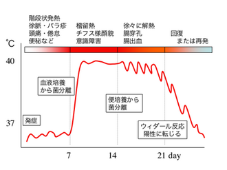 腸チフスの症状の推移を示す体温変化のグラフ