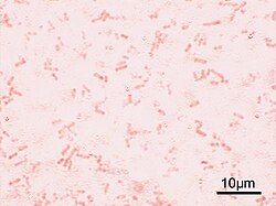 赤痢菌(シゲラ)の生物学的特徴と病原性