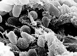 ペスト菌の生物学的特徴と歴史的影響