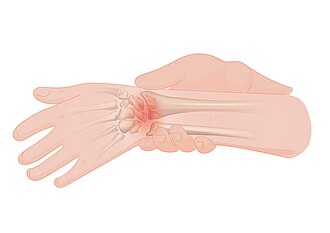 痛み：生理学的・心理学的メカニズムと臨床的特徴