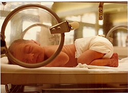 未熟児は医師の管理の許、うつぶせ寝をさせられている場合がある。しかし通常、新生児はまだ自分で寝返りをすることができず、赤ちゃんのうつぶせ寝は口の周りにある物や吐瀉物が口に入り窒息する恐れがある。また、乳幼児突然死症候群 (SIDS) の原因という説もある。従って現在、家庭ではあまり薦められていない。